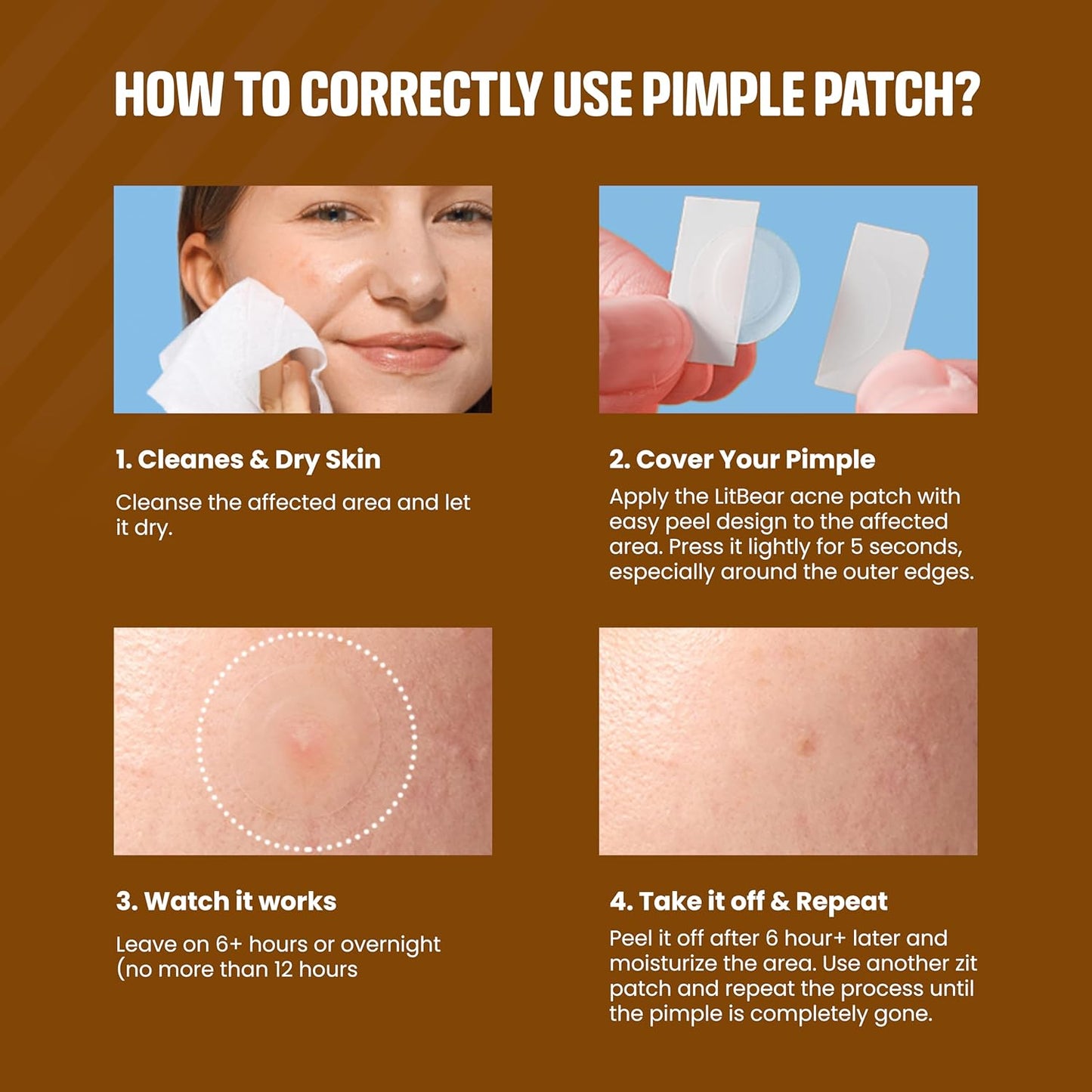 how to use pimple patches