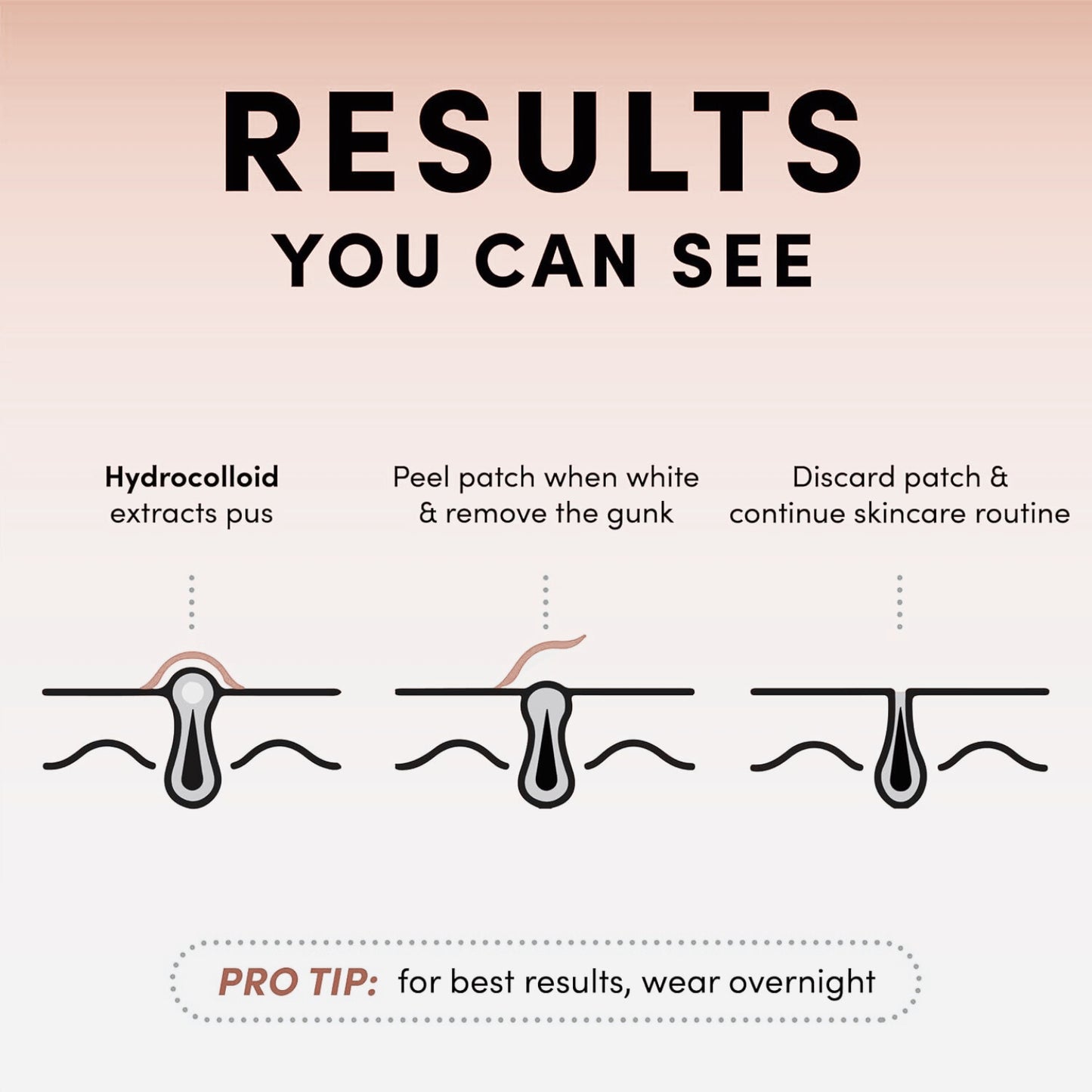 acne pimple patch result