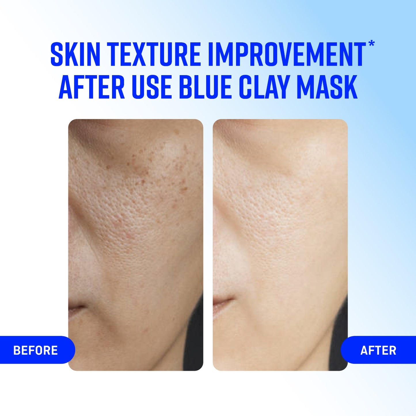 COANC Blue Clay Mask |Face Pack for Glowing Skin | All Skin Types | Men & Women