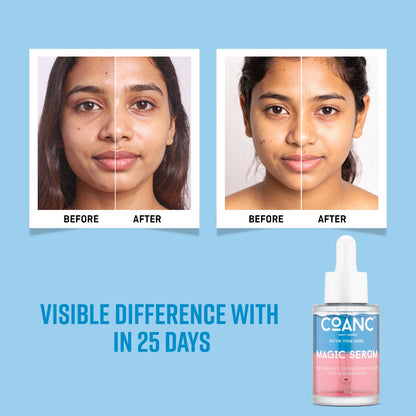 COANC India's 1st  Magic Serum For Glass Skin| Promotes Skin Radiant & Youthful Glow | Fades Dark Sports & Hyperpigmentation
