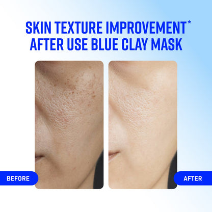 COANC Blue Clay Mask |Face Pack for Glowing Skin | All Skin Types | Men & Women